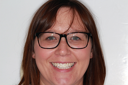After Invisalign Treatment Smile Rooms Glasgow