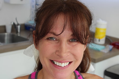 Before Invisalign Treatment Smile Rooms Glasgow